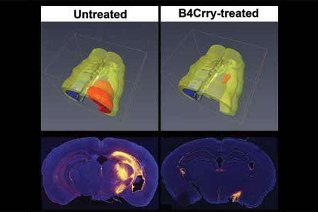 dampening injury after stroke