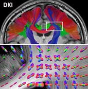 Fiber tractography using diffusional kurtosis imaging