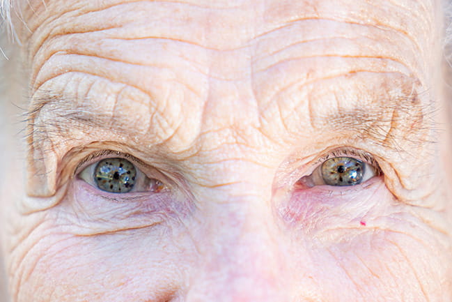 Closeup of woman’s eyes looking straight at camera