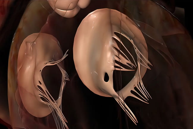 Close-up illustration of functioning heart valves